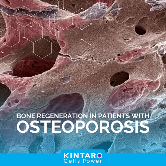 Kintaro Stem Cells® and Osteoporosis