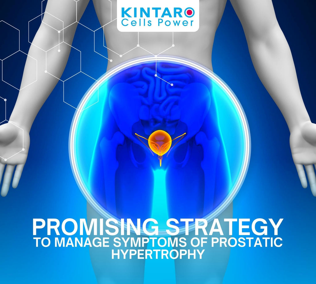 Kintaro Stem Cells® and Prostatic Hypertrophy