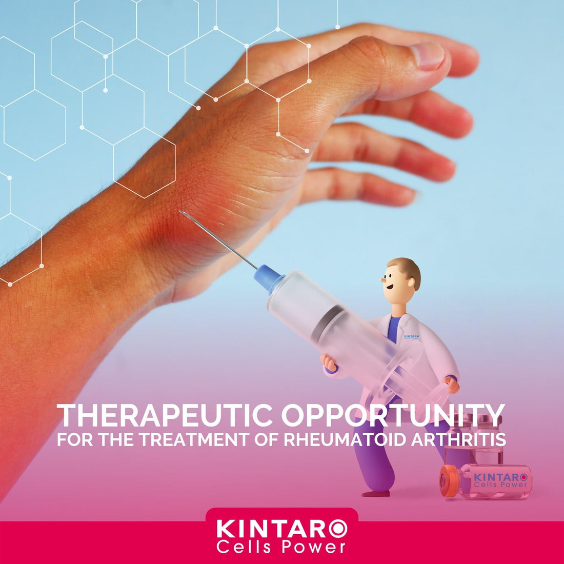 Kintaro Stem Cells® Therapy for Rheumatoid Arthritis