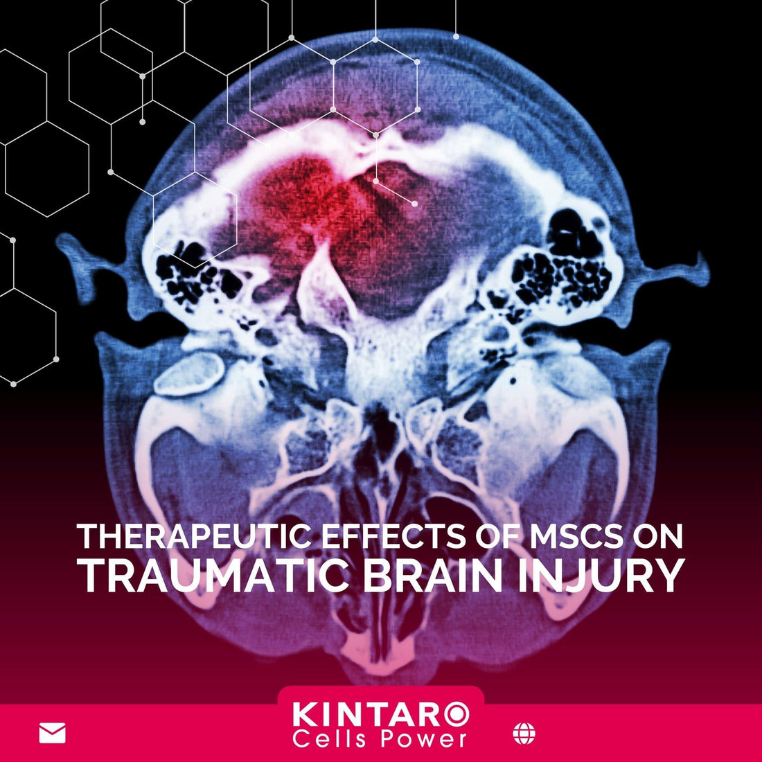 Therapeutic Effects of MSCs on Traumatic Brain Injury Cases