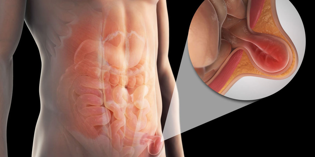 Are Kintaro Stem Cells® a Possible Cure for Hernia?